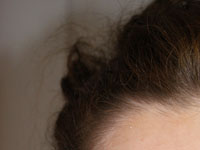 Meso-Hair
